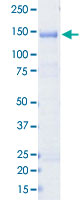 Loading 1 &mu;g protein in SDS-PAGE